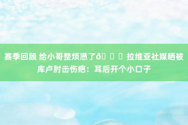 赛季回顾 给小哥整烦懑了😅拉维亚社媒晒被库卢肘击伤疤：耳后开个小口子